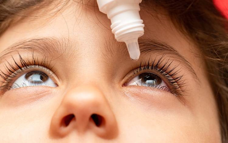 Eye Drop Proven to Slow Myopia Progression in Children